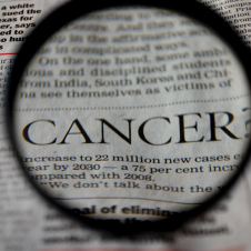 Killer KN/T-Cell Lymphoma